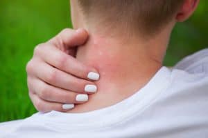 Come eliminare le fonti di proliferazione delle zanzare